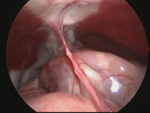 cd6be542c03e05064d96d5ea3726b6f6
